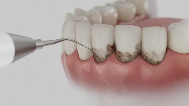 Reliable Tooth Extraction contractor in Jacksonville, TX by Smile Center Dentistry